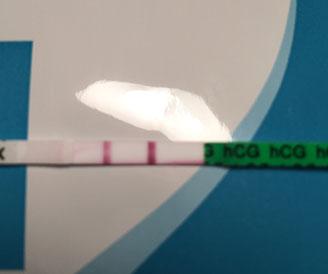 Wondfo Test Strips Pregnancy Test, 17 Days Post Ovulation, FMU