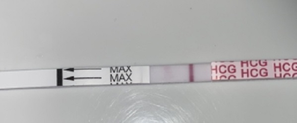 AccuMed Pregnancy Test, 11 Days Post Ovulation, FMU