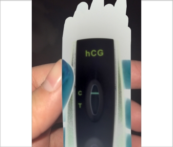 First Signal One Step Pregnancy Test, 8 Days Post Ovulation